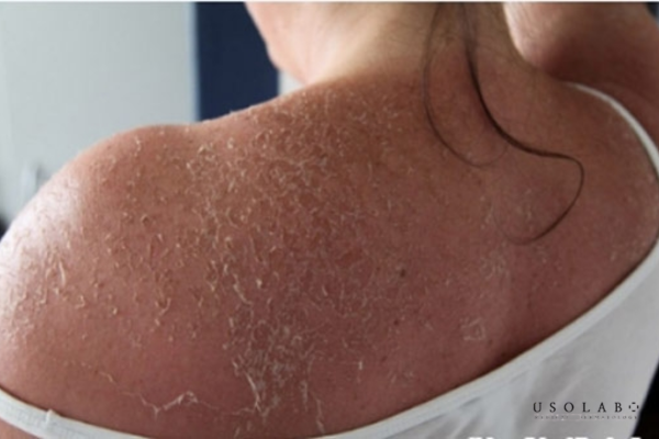 Kỳ vọng “trắng cấp tốc” (marketing vs thực tế)