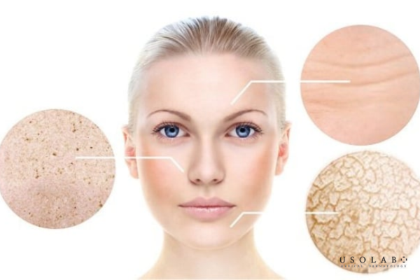 Da khô cần dưỡng ẩm sâu