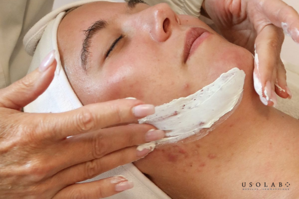 Dùng sai loại da Dùng sai loại da