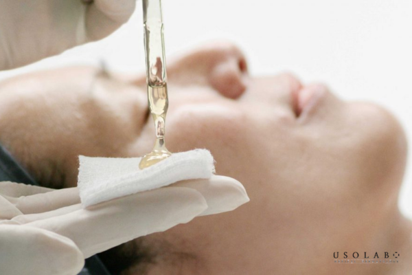 peel da bị nổi mụn nước