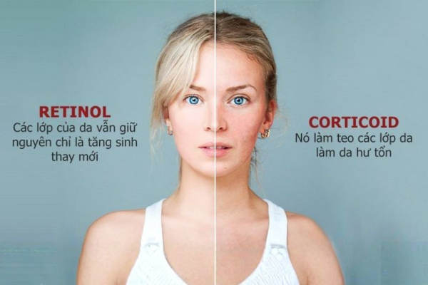 Da khô vẫn có thể sử dụng retinol, nhưng cần theo hướng “phục hồi trước – hoạt hóa sau”