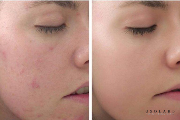 Những sai lầm khiến serum phục hồi “mất tác dụng”
