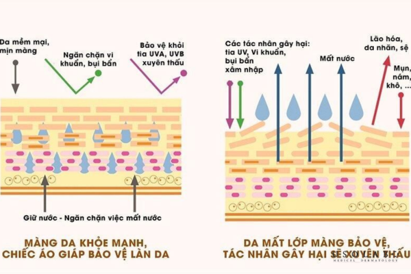 Hàng rào bảo vệ da yếu