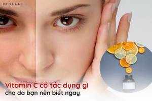 vitamin c có tác dụng gì cho da