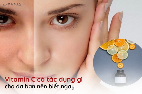 vitamin c có tác dụng gì cho da
