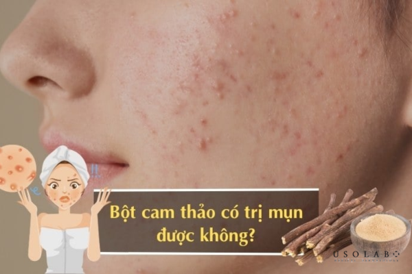 Sử dụng quá thường xuyên và không test trước khi dùng