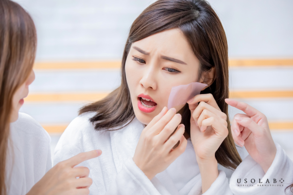 Da dầu mất kiểm soát