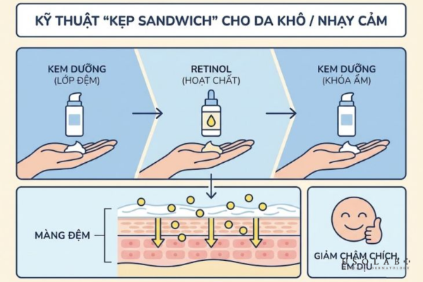 Kỹ thuật "Sandwich" với Retinoids