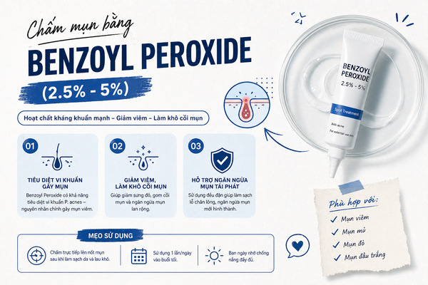 Chấm mụn bằng Benzoyl Peroxide (2.5% - 5%)