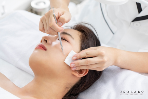 Mụn sưng to quá có thể đi chích lể để làm xẹp mụn