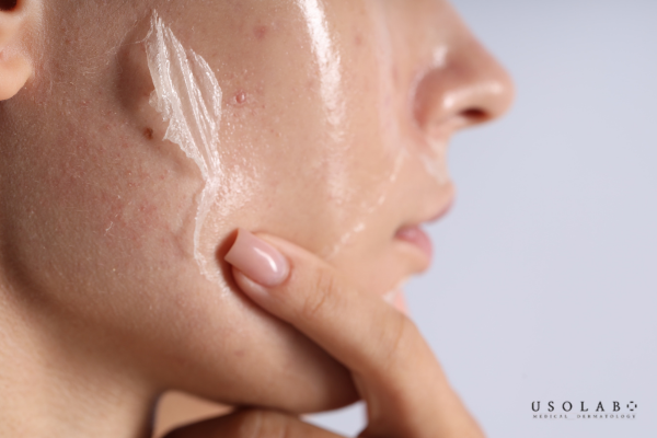 Nhiều người tin rằng chỉ cần uống nhiều nước là đủ để cải thiện làn da