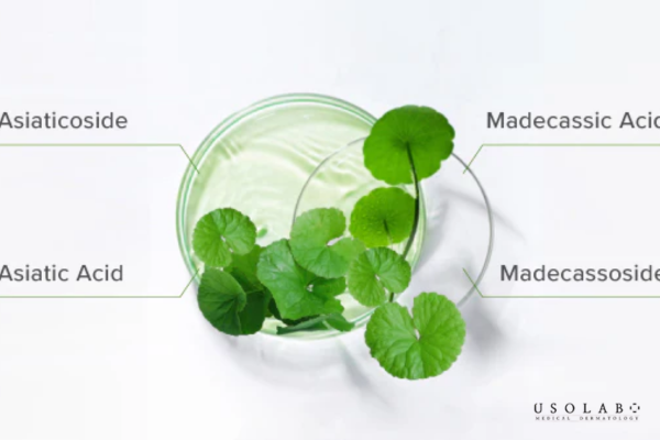 Uống rau má giúp giảm mụn chủ yếu nhờ hệ hoạt chất sinh học đặc trưng của Centella asiatica Uống rau má giúp giảm mụn chủ yếu nhờ hệ hoạt chất sinh học đặc trưng của Centella asiatica