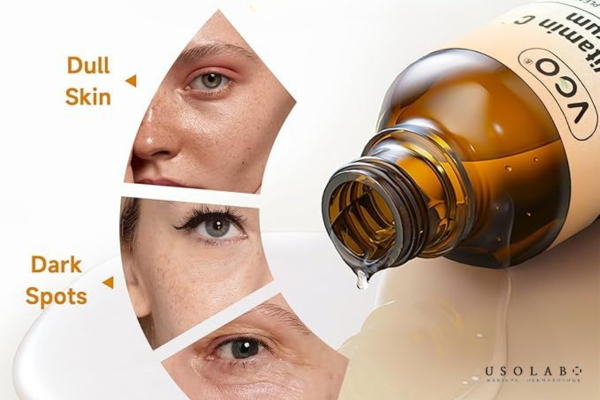 vitamin a có tác dụng gì cho da