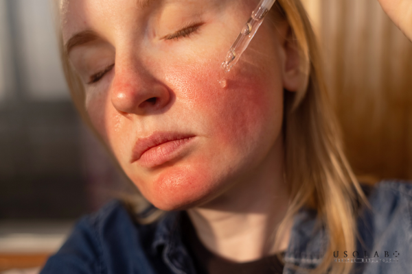 Ở góc độ chuyên gia da liễu, nếu phải chọn một loại vitamin B tốt nhất cho da mặt Ở góc độ chuyên gia da liễu, nếu phải chọn một loại vitamin B tốt nhất cho da mặt