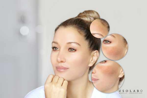 Để hiểu rõ vitamin B có tác dụng gì cho da mặt, cần đặt trong bối cảnh từng loại da Để hiểu rõ vitamin B có tác dụng gì cho da mặt, cần đặt trong bối cảnh từng loại da