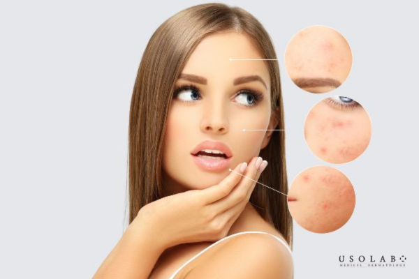 Vitamin B12 có tác dụng gì cho da