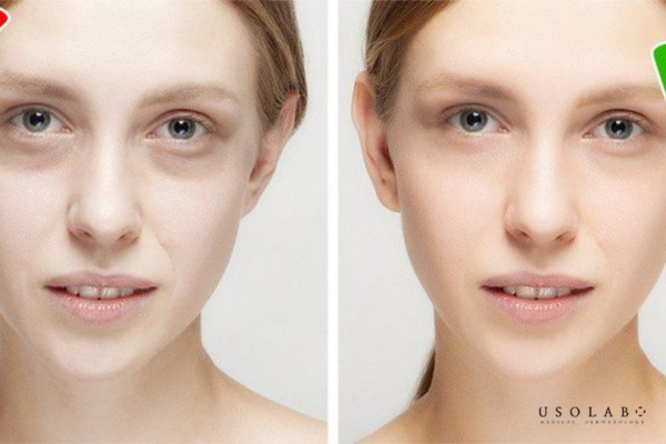 Vitamin B12 không phải là vi chất cần bổ sung đại trà cho tất cả mọi người