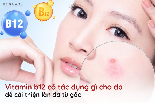 vitamin b12 có tác dụng gì cho da