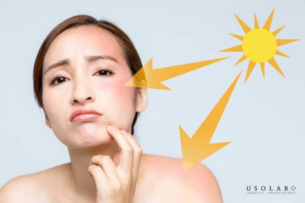 cách làm trắng da mặt tự nhiên không bắt nắng