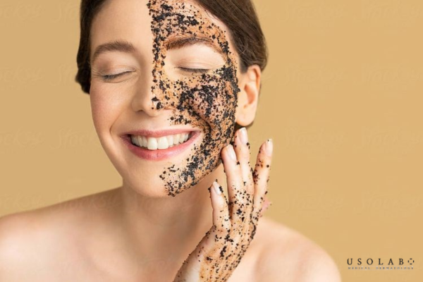 da kích ứng sau peel