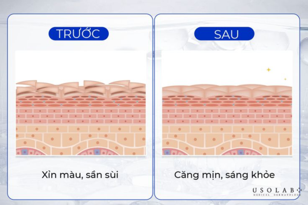 da sau lăn kim nên dùng gì