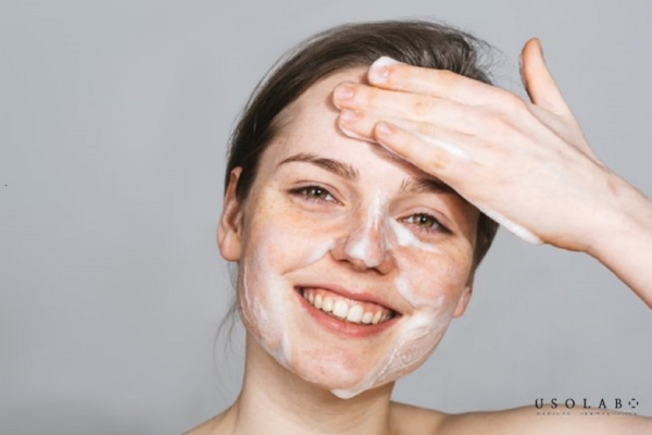 da kích ứng sau peel