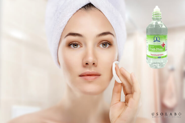 da kích ứng sau peel