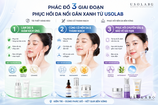 da mặt nổi gân xanh