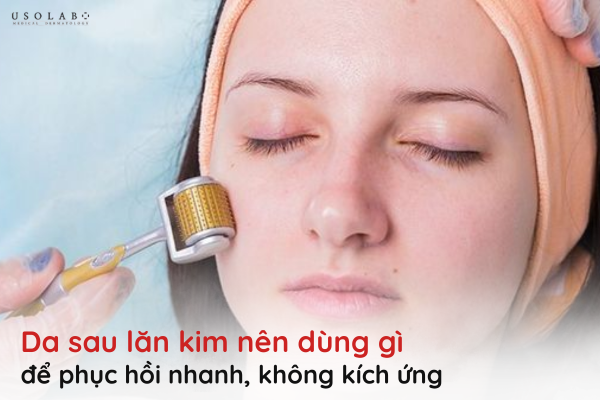 da sau lăn kim nên dùng gì