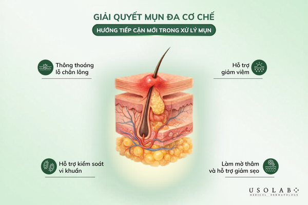 Cơ chế kháng khuẩn của dầu tràm với da mụn