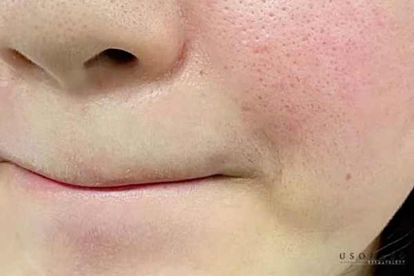 kem phục hồi chuyên sâu