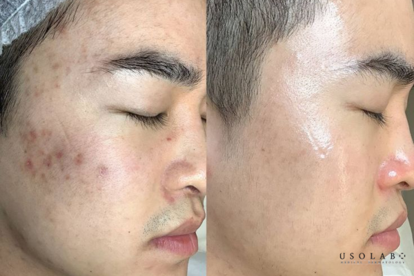 kem phục hồi chuyên sâu