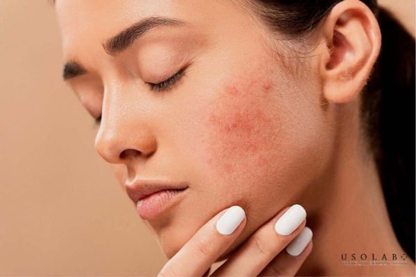 kem phục hồi chuyên sâu