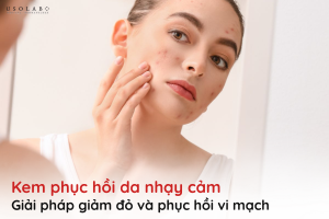 kem phục hồi da nhạy cảm