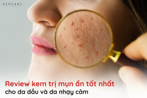 kem trị mụn ẩn