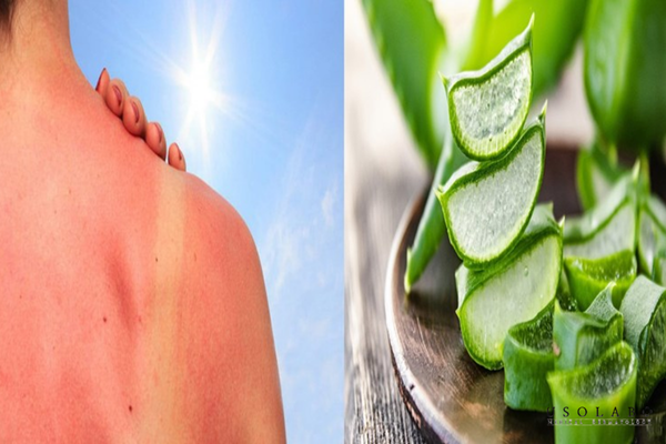phục hồi da sau cháy nắng