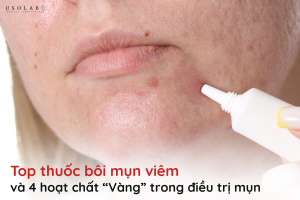 thuốc bôi mụn viêm