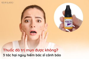thuốc đỏ có trị mụn được không