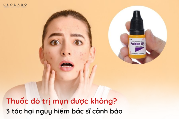 thuốc đỏ có trị mụn được không