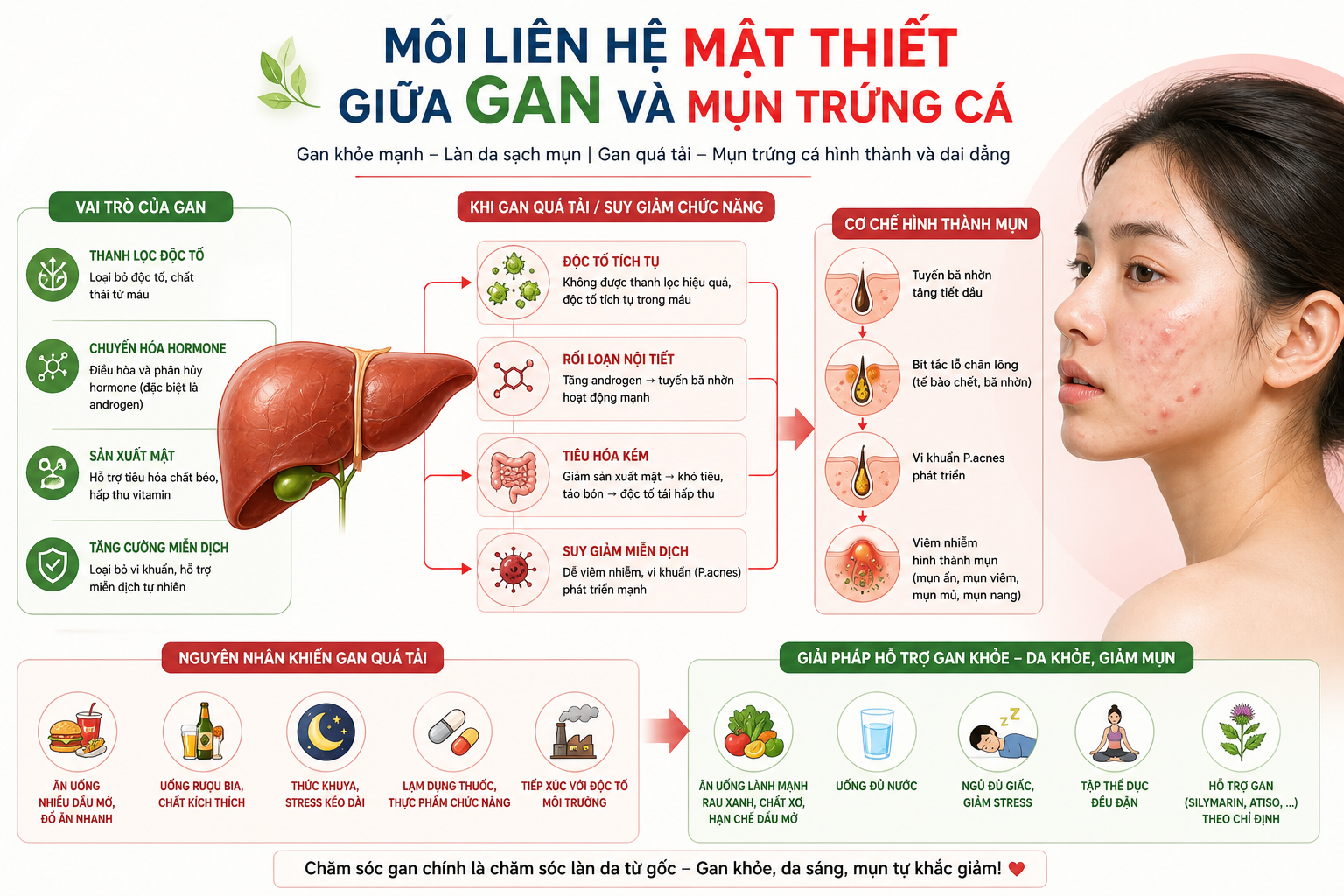 uống gì cho mát gan hết mụn