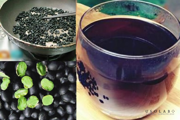 uống gì cho mát gan hết mụn