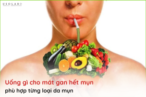 uống gì cho mát gan hết mụn