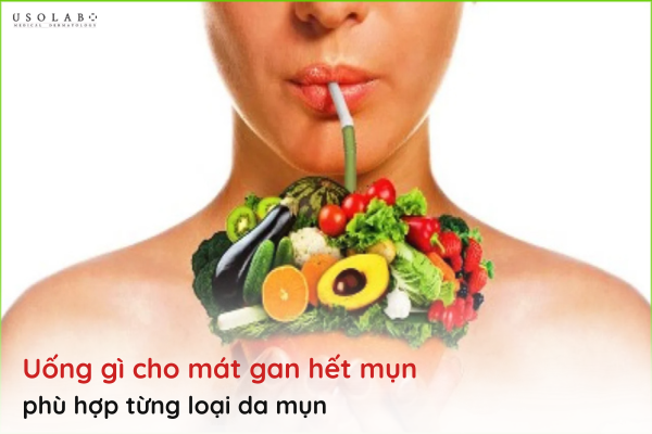 uống gì cho mát gan hết mụn