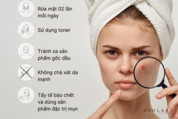 vị trí nổi mụn