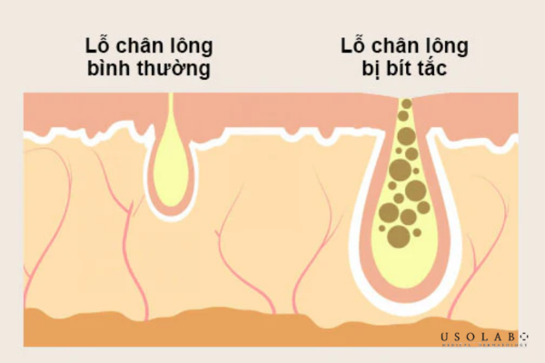 xịt chống nắng
