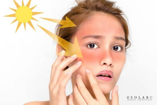 xịt chống nắng