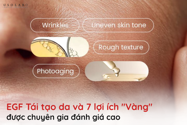 EGF tái tạo da