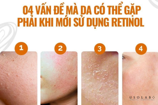 ghk-cu phục hồi da