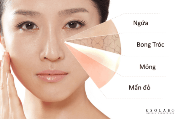 Đối tượng nào được khuyên dùng sản phẩm chứa Palmitamide MEA