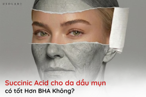 succinic acid cho da dầu